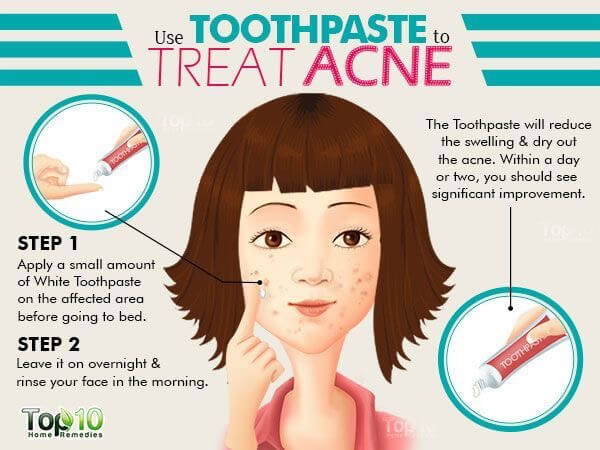 Toothpaste is the perfect backpacking beauty hack for pimples.